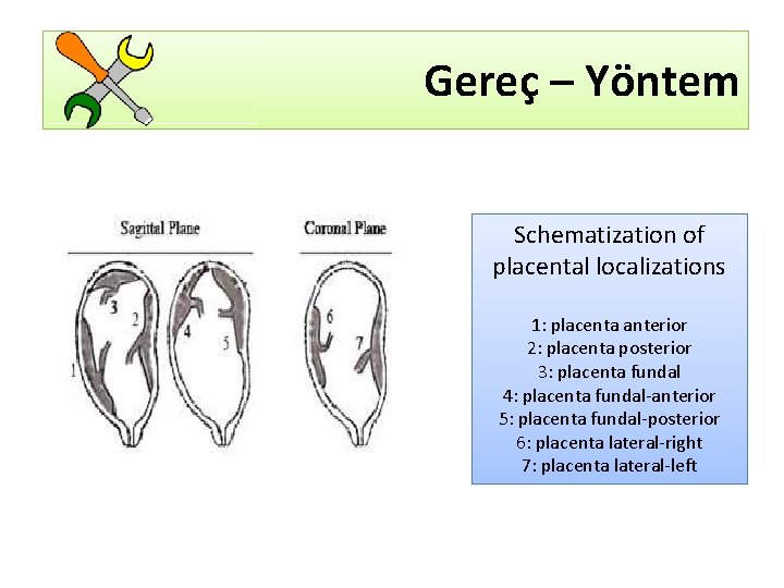 Gereç – Yöntem Schematization of placental localizations 1: placenta anterior 2: placenta posterior 3: