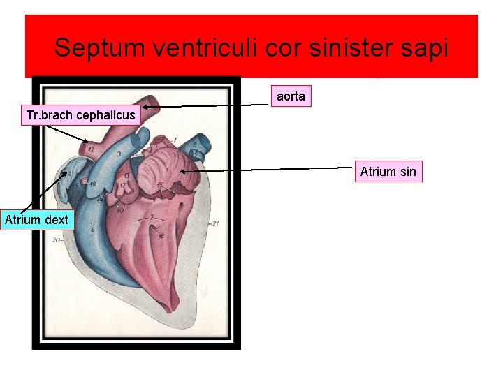 Septum ventriculi cor sinister sapi aorta Tr. brach cephalicus Atrium sin Atrium dext 