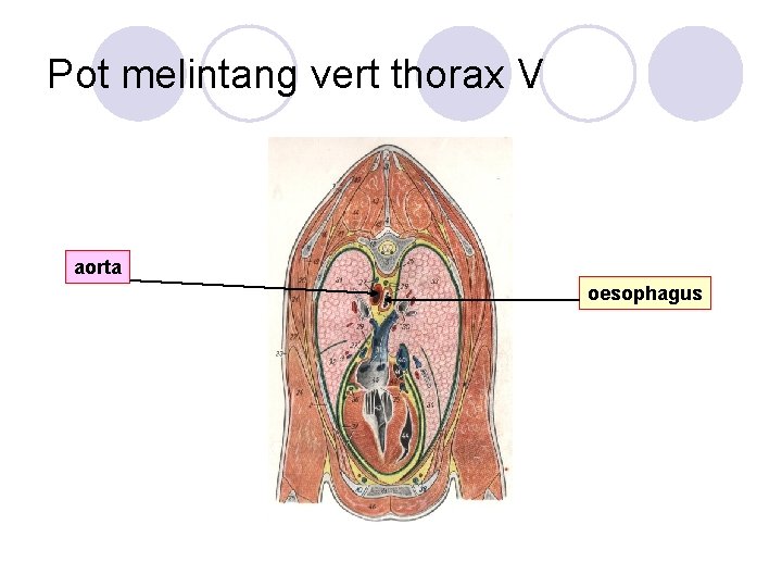 Pot melintang vert thorax V aorta oesophagus 