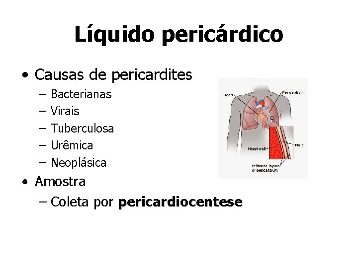Líquido pericárdico • Causas de pericardites – – – Bacterianas Virais Tuberculosa Urêmica Neoplásica