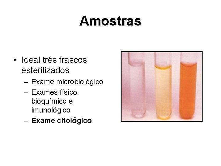 Amostras • Ideal três frascos esterilizados – Exame microbiológico – Exames físico bioquímico e