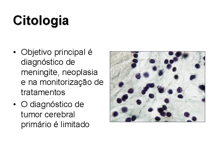 Citologia • Objetivo principal é diagnóstico de meningite, neoplasia e na monitorização de tratamentos
