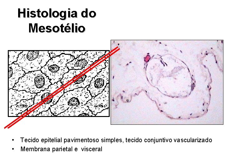 Histologia do Mesotélio • Tecido epitelial pavimentoso simples, tecido conjuntivo vascularizado • Membrana parietal