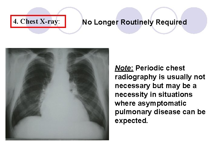4. Chest X-ray: No Longer Routinely Required Note: Periodic chest radiography is usually not