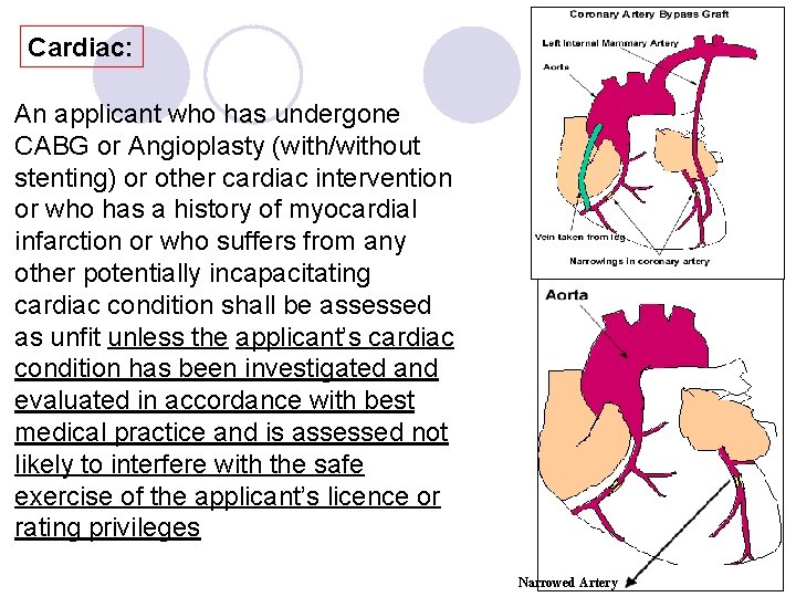 Cardiac: An applicant who has undergone CABG or Angioplasty (with/without stenting) or other cardiac