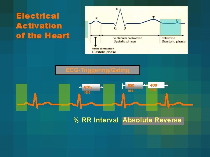 Electrical Activation of the Heart ECG-Triggering/Gating 60% RR 600 ms 400 ms % RR