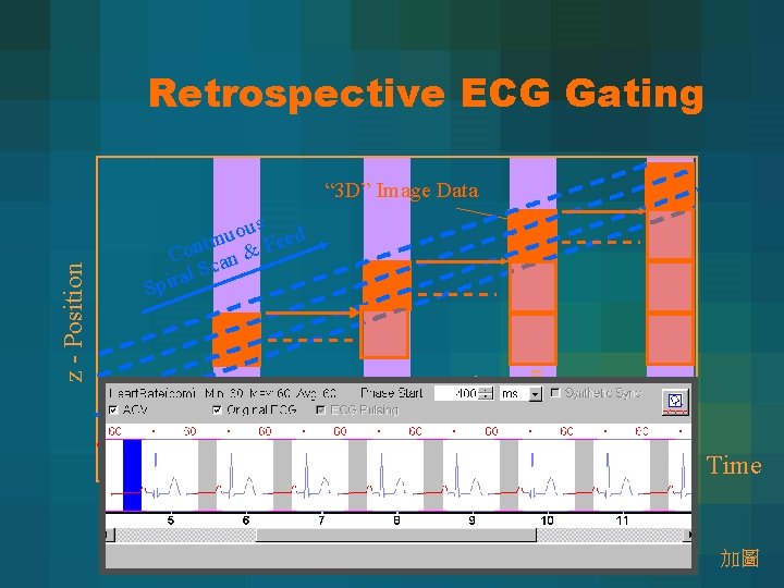Retrospective ECG Gating “ 3 D” Image Data R R Recon Delay Recon R