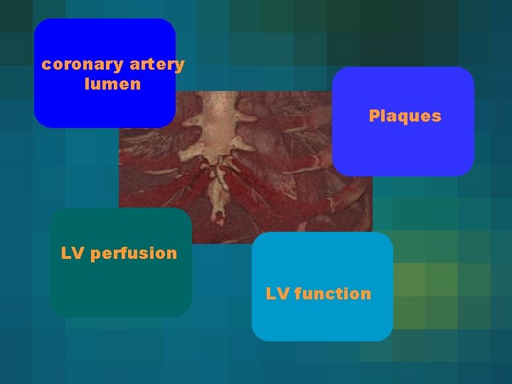 coronary artery lumen Plaques LV perfusion LV function 