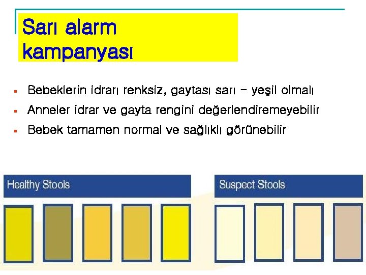 Sarı alarm kampanyası § Bebeklerin idrarı renksiz, gaytası sarı - yeşil olmalı § Anneler Sarı alarm kampanyası § Bebeklerin idrarı renksiz, gaytası sarı - yeşil olmalı § Anneler