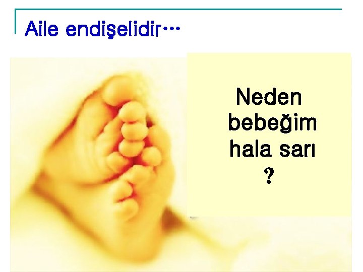 Aile endişelidir… Neden bebeğim hala sarı Aile endişelidir… Neden bebeğim hala sarı