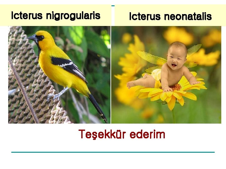 Icterus nigrogularis Icterus neonatalis Teşekkür ederim Icterus nigrogularis Icterus neonatalis Teşekkür ederim
