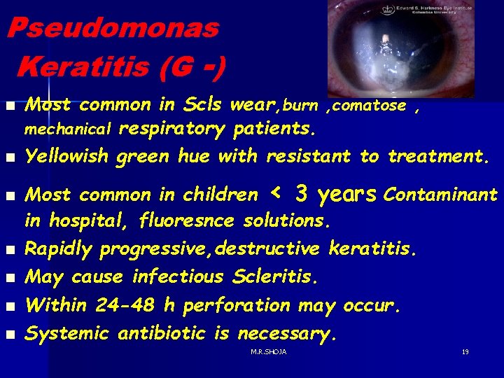 Pseudomonas Keratitis (G -) n n n n Most common in Scls wear, burn