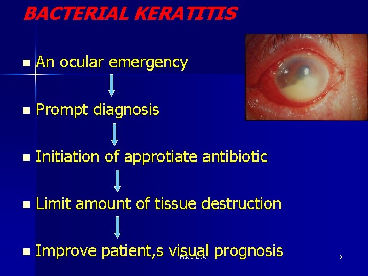 BACTERIAL KERATITIS n An ocular emergency n Prompt diagnosis n Initiation of approtiate antibiotic