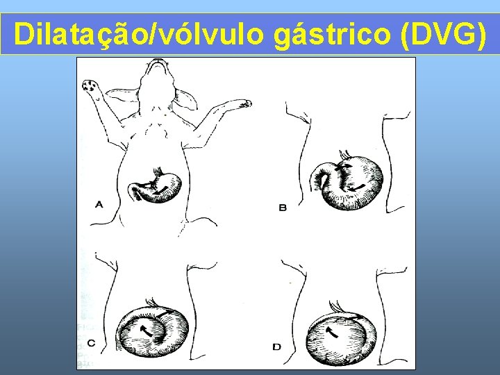 Dilatação/vólvulo gástrico (DVG) 