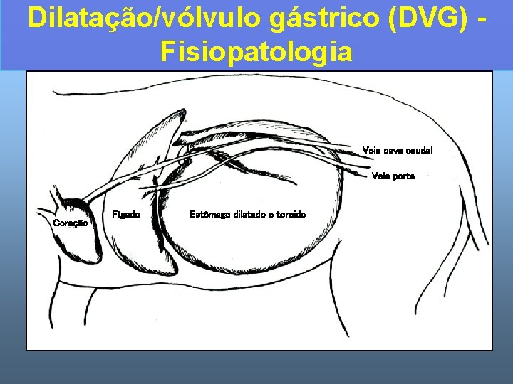 Dilatação/vólvulo gástrico (DVG) Fisiopatologia Veia cava caudal Veia porta Coração Fígado Estômago dilatado e