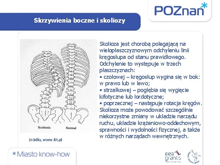 Skrzywienia boczne i skoliozy źródło, www. fit. pl Skolioza jest chorobą polegającą na wielopłaszczyznowym