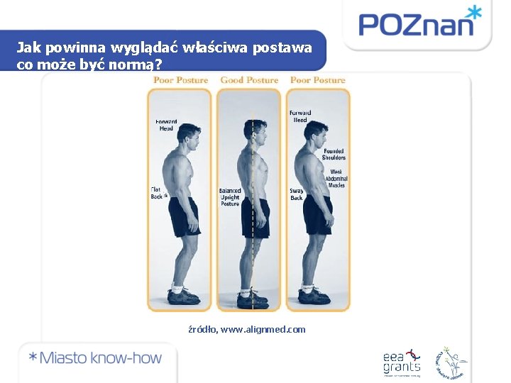 Jak powinna wyglądać właściwa postawa co może być normą? źródło, www. alignmed. com 