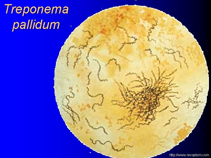 Treponema pallidum http: //www. revoptom. com 