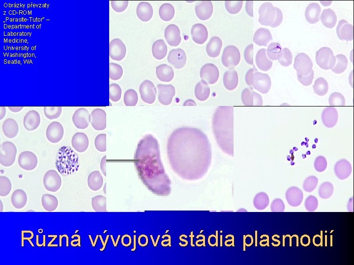 Obrázky převzaty z CD-ROM „Parasite-Tutor“ – Department of Laboratory Medicine, University of Washington, Seatle,