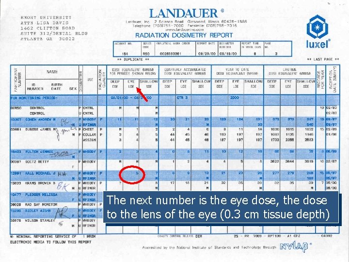 The next number is the eye dose, the dose to the lens of the