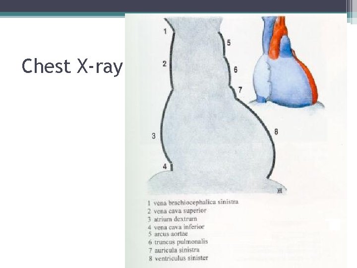 Chest X-ray 