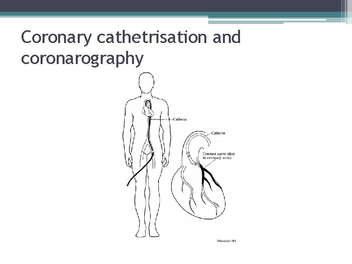 Coronary cathetrisation and coronarography 