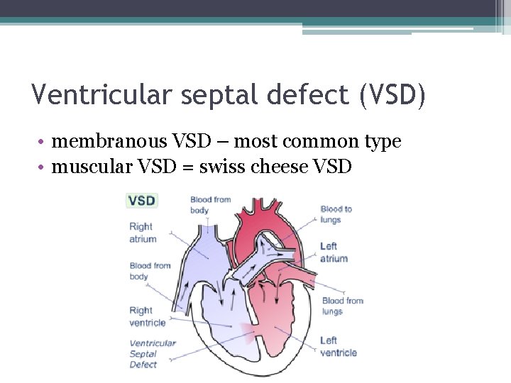 Ventricular septal defect (VSD) • membranous VSD – most common type • muscular VSD