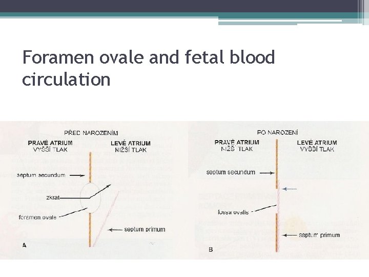 Foramen ovale and fetal blood circulation 