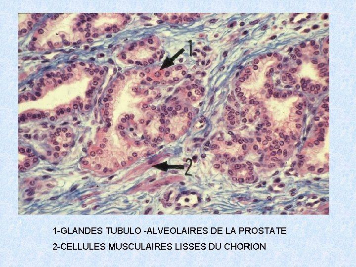 1 -GLANDES TUBULO -ALVEOLAIRES DE LA PROSTATE 2 -CELLULES MUSCULAIRES LISSES DU CHORION 