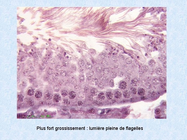 Plus fort grossissement : lumière pleine de flagelles 
