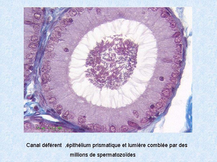 Canal déférent , épithélium prismatique et lumière comblée par des millions de spermatozoïdes 