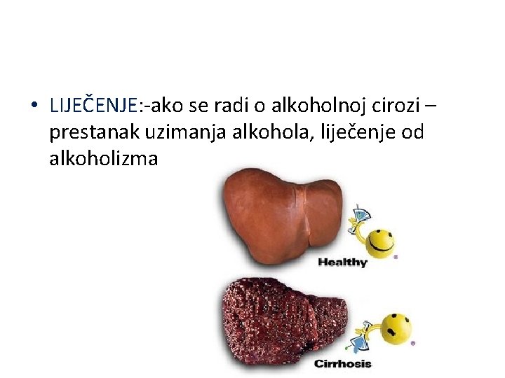  • LIJEČENJE: -ako se radi o alkoholnoj cirozi – prestanak uzimanja alkohola, liječenje