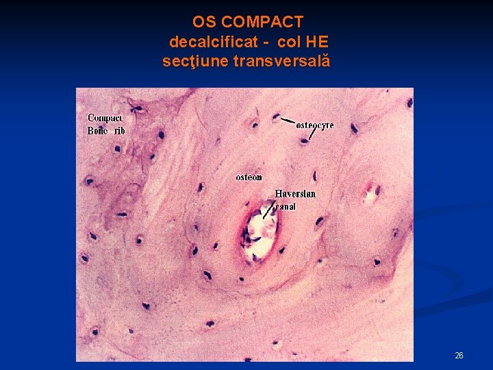 OS COMPACT decalcificat - col HE secţiune transversală 26 