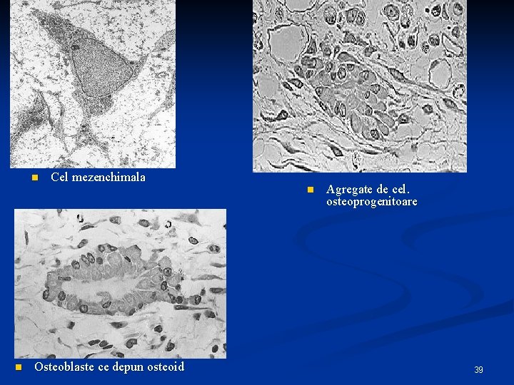 n Cel mezenchimala n n Osteoblaste ce depun osteoid Agregate de cel. osteoprogenitoare 39