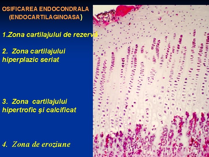OSIFICAREA ENDOCONDRALA (ENDOCARTILAGINOASA) 1. Zona cartilajului de rezervă 2. Zona cartilajului hiperplazic seriat 3.