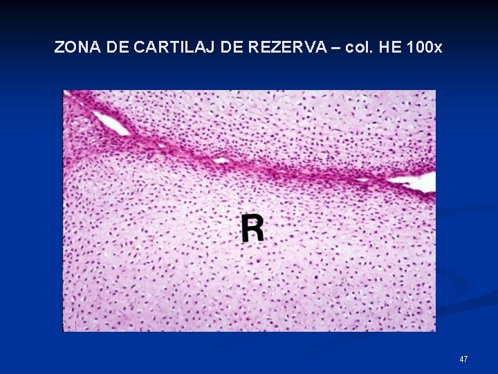 ZONA DE CARTILAJ DE REZERVA – col. HE 100 x 47 