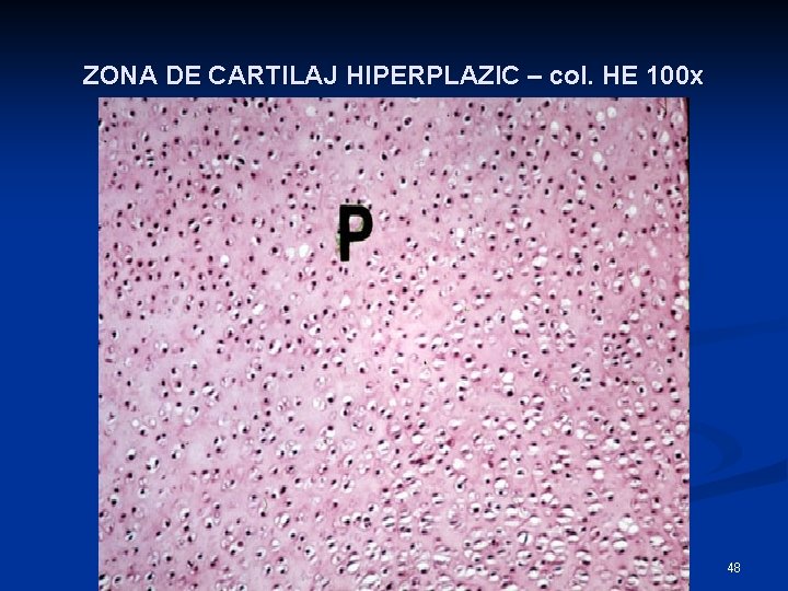 ZONA DE CARTILAJ HIPERPLAZIC – col. HE 100 x 48 