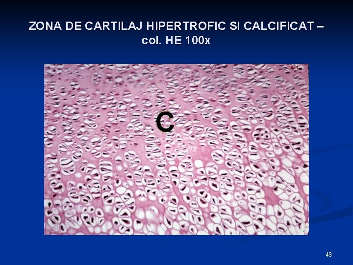 ZONA DE CARTILAJ HIPERTROFIC SI CALCIFICAT – col. HE 100 x 49 