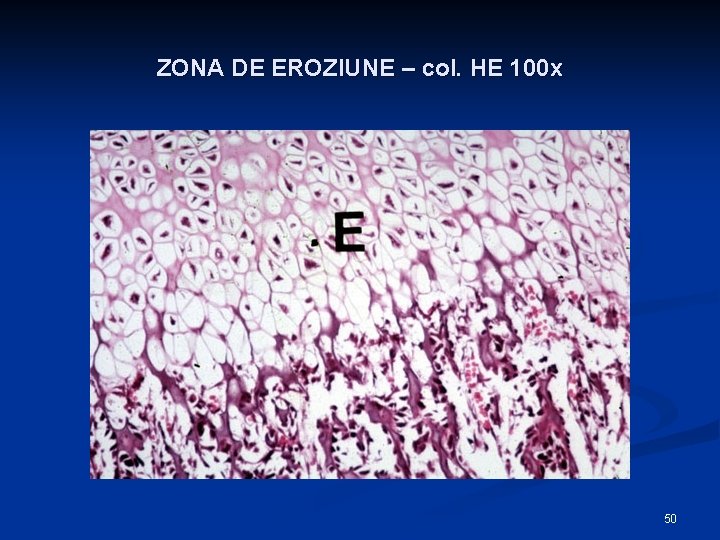 ZONA DE EROZIUNE – col. HE 100 x 50 