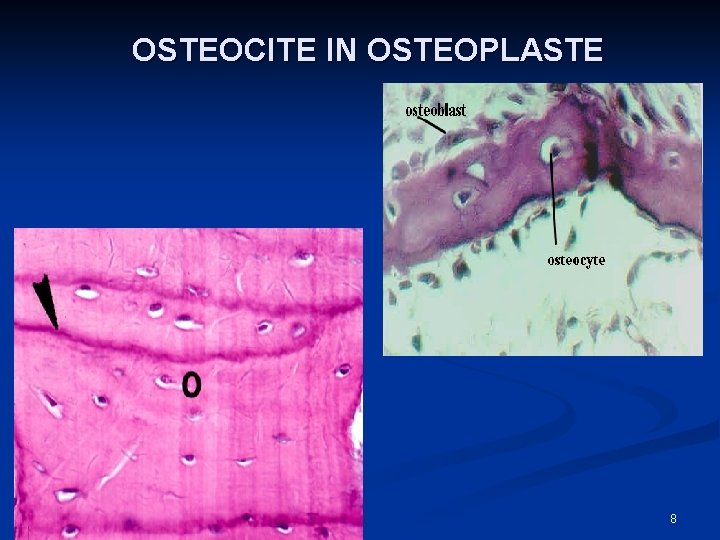 OSTEOCITE IN OSTEOPLASTE 8 