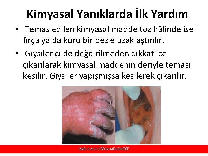 Kimyasal Yanıklarda İlk Yardım • Temas edilen kimyasal madde toz hâlinde ise fırça ya Kimyasal Yanıklarda İlk Yardım • Temas edilen kimyasal madde toz hâlinde ise fırça ya