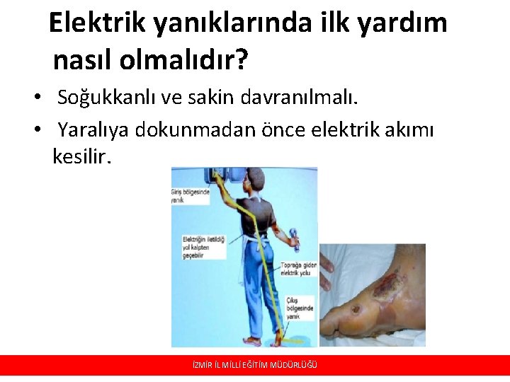 Elektrik yanıklarında ilk yardım nasıl olmalıdır? • Soğukkanlı ve sakin davranılmalı. • Yaralıya dokunmadan Elektrik yanıklarında ilk yardım nasıl olmalıdır? • Soğukkanlı ve sakin davranılmalı. • Yaralıya dokunmadan