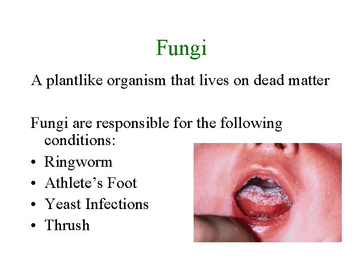 Fungi A plantlike organism that lives on dead matter Fungi are responsible for the