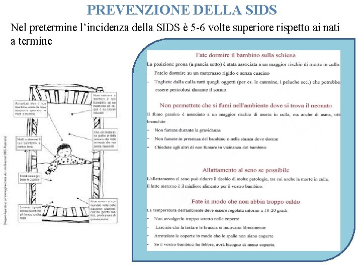 PREVENZIONE DELLA SIDS Nel pretermine l’incidenza della SIDS è 5 -6 volte superiore rispetto