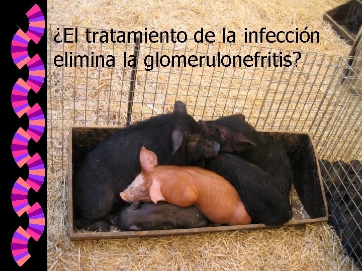 ¿El tratamiento de la infección elimina la glomerulonefritis? 