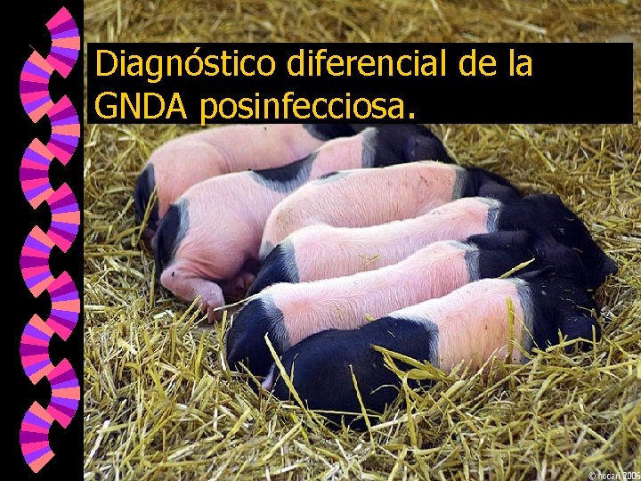 Diagnóstico diferencial de la GNDA posinfecciosa. 