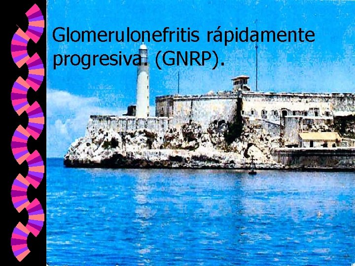 Glomerulonefritis rápidamente progresiva. (GNRP). 