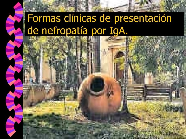 Formas clínicas de presentación de nefropatía por Ig. A. 