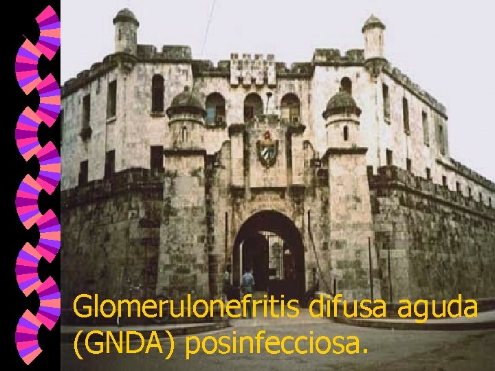 Glomerulonefritis difusa aguda (GNDA) posinfecciosa. 