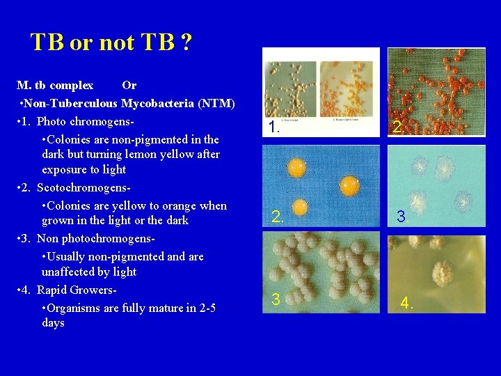 TB or not TB ? M. tb complex Or • Non-Tuberculous Mycobacteria (NTM) •